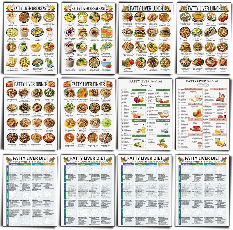 Sinload 12 Pcs Fatty Liver Food Chart Poster Diet Grocery List Meal Plan Health Diet for Kitchen Room Decor - Image 1